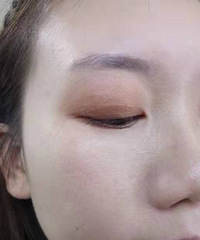 分享肿泡眼单眼皮的技巧,学会这个方法,节省了割双眼皮的钱了