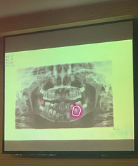 һͼ㣬綪ʧԺӵĺʲôӰ