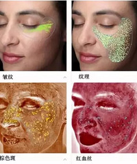 小气泡、果酸焕肤和水光针,原来这个是真正有用的