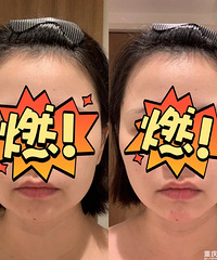 雅萌“吃鸡”面罩,去水肿效果好惨了