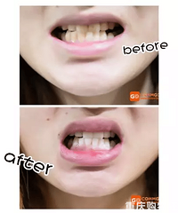 2.8ݡϴŹ,ײҿǻҽԺʵȦ