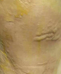 ��ɯ�λ�ޱ�����