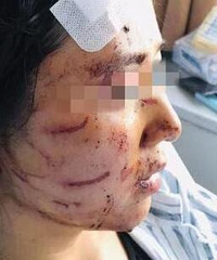 温州一女子被其丈夫和公公强塞大便