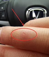 ��Сèצ����Ҫ��������