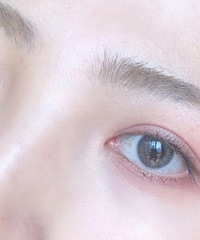 ����ʡ��ҽ���οƣ�����˫��Ƥ����ע����������Щ��