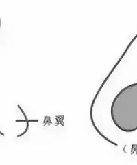 贵阳隆鼻医院|隆鼻失败的常见症状有哪些?