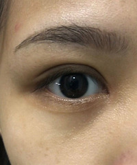 ������˫��Ƥ���ۺϰ�����Щ��Ŀ��