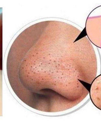 ԿͷտҪ־սԱѡ2%ˮᾫҺ