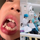 娃儿的牙齿长成了这样