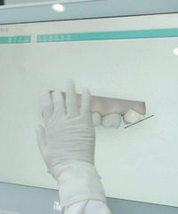 这家资深口腔医院洁牙只要49.9,安排上