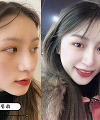 做了个满意的纹眉,拯救了我的高低眉