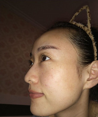 做检测看到一脸的深层斑点被吓到,幸好这个能祛掉