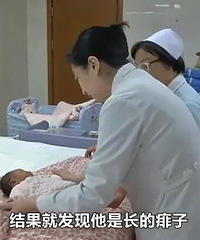 裹太多,刚出生两天的婴儿,在医院产科洗澡时,被发现长满痱子