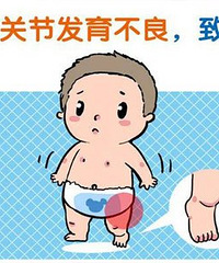 带宝宝做儿保,医生发现腿纹不对称,复查说是髋关节发育不良