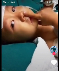 黄石四岁小宝宝被传染,在重症室哭喊,妈妈救我!