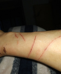 ��èץ��֮��...