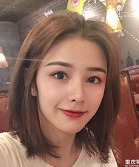 隆鼻后气质和颜值直线上升,朋友都都说我改变很大