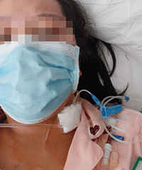 二胎妈妈患上新冠的生死21天