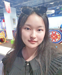 单眼皮变双眼皮后,变得自然又有神,一点都没后悔