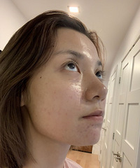 来分享下打水光针的经历,其实性价比一般