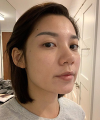 来分享下去年夏天打水光针的经历,其实性价比一般