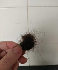 六个月减40斤不吃主食的副作用,就是掉很多头发