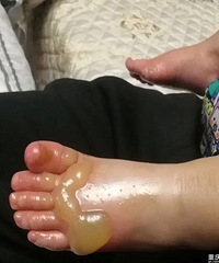 公公婆婆和老公三个人带不好孩子,娃儿被烫得好惨