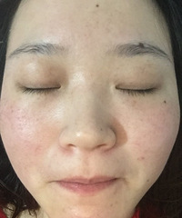 斑点没了后,化妆都不费遮瑕膏了