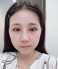 做完双眼皮没有任何变化,有点小后悔了