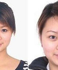 说说那些整容的明星,鞠婧祎绝对是整容范本