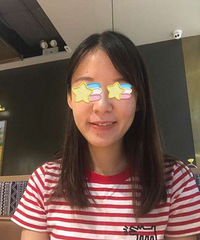 第一次光子嫩肤祛痘,做了几次后下巴痘痘都没了