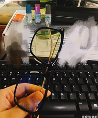 近视眼激光手术并不可怕,做完半年视力依旧1.2