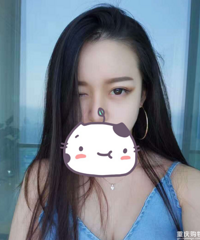 ������˫��Ƥ�����۾�û���񣬸���˫��Ƥ����˺ܶ�