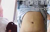 ¶��ļ������ˣ�128Ԫ���ŵĲ���ָ�Ч��̫����