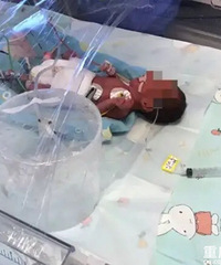奇迹!福州“巴掌宝宝”半岁啦!背后故事催泪……