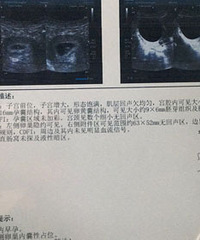 纠结到底要不要肚子里的孩子