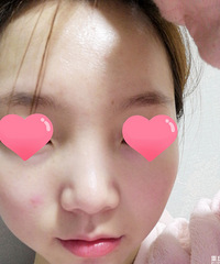 �������У�ȱˮ�����ͣ��������Ƥ����Ŀ������һ���ȡ�