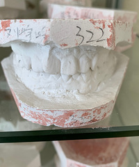 窟牙居然能瘦脸,太惊喜了!侧面看脸线条很明显