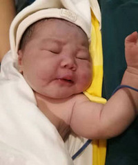 生娃经历了大出血、二次缝合