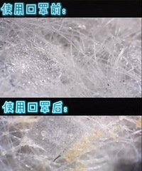 你的口罩多久一换?把使用过的口罩放大1000倍后吓一跳