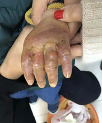 起底婴儿趴睡身亡涉事机构:孩子烫伤仍一个人睡,哭了不许安抚