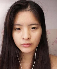 双眼皮开眼角不用割?变大外双后,整个人气质都变了,你们觉得呢