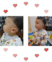 生孩子不止你一个人在努力,娃儿头上都是经过产道挤压的血泡