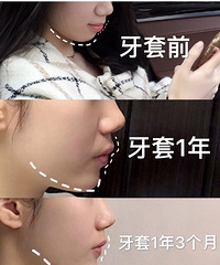 ֲݣ͹ķ̫Чˣ1б仯