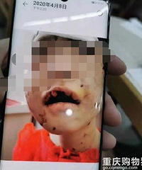 慎入!亲爸后妈虐待4岁的女儿,孩子嘴巴被剪在厕所吃纸