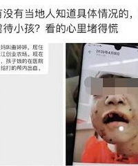 慎入!4岁孩子被亲爸后妈残忍虐待