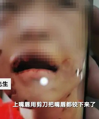 遭继母虐待女童生母回应,称自己条件不好,还要供弟弟上学