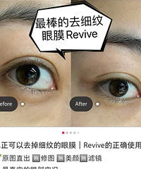 ���м��ĺ���������������Ƥ����⻬�����н�����Сë�׵�Ч��