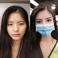 有双眼皮后气质都变了