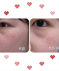 һ��ҽ�����ƺ�--��¼���һ���������ҽ��֮·